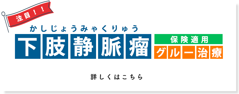 下肢静脈瘤グルー治療