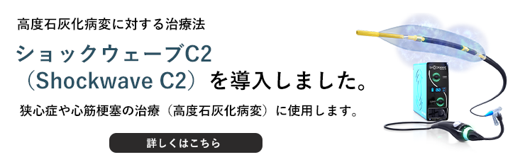 ショックウェーブ