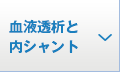 血液透析と内シャント