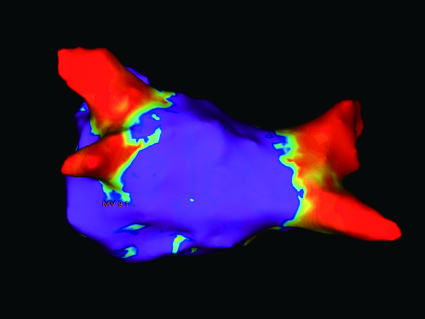 三次元マッピング