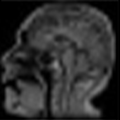 MRI（核磁気共鳴画像法）装置